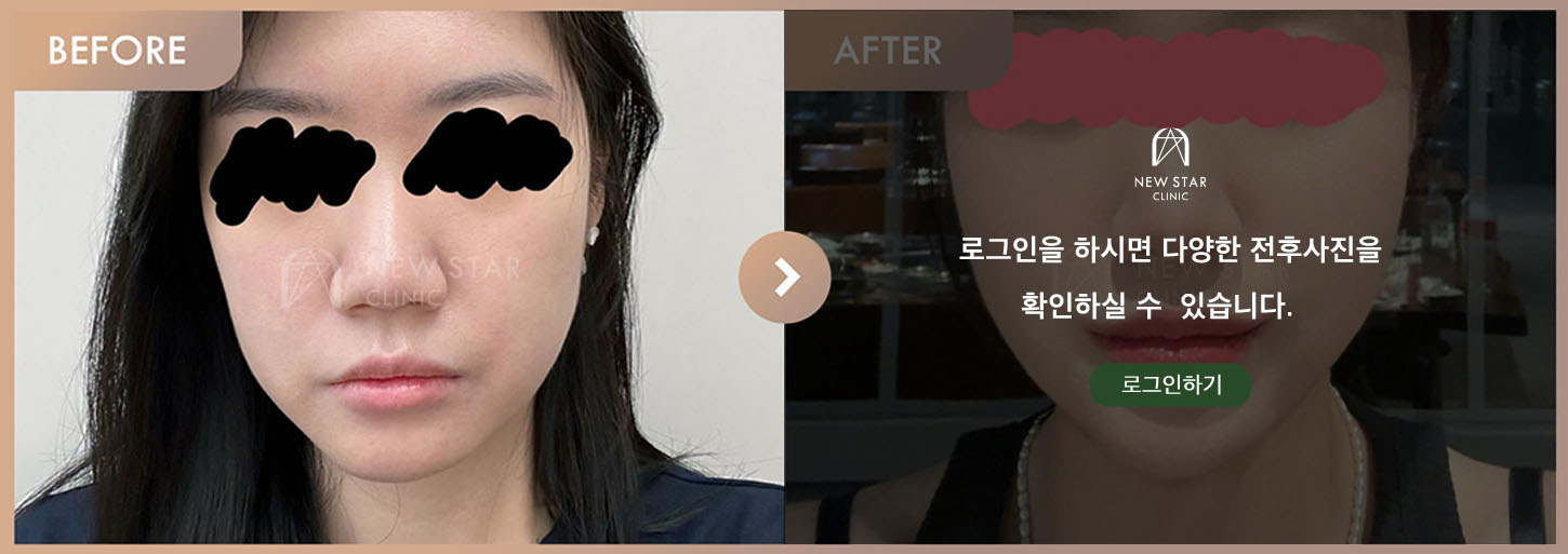 前后对比