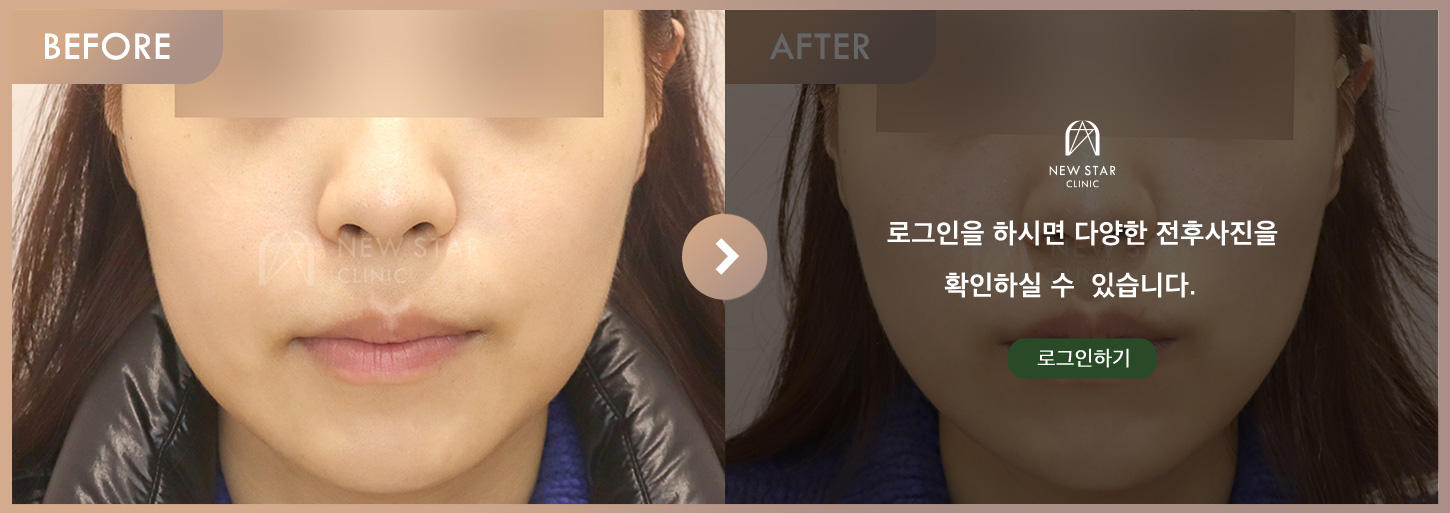 前后对比