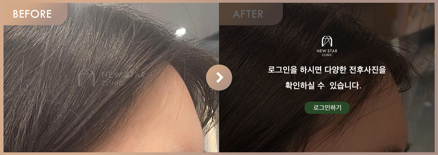 Before & After