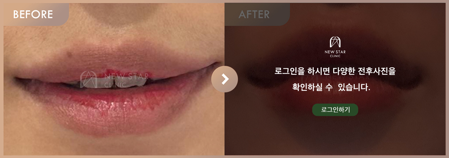 Before & After