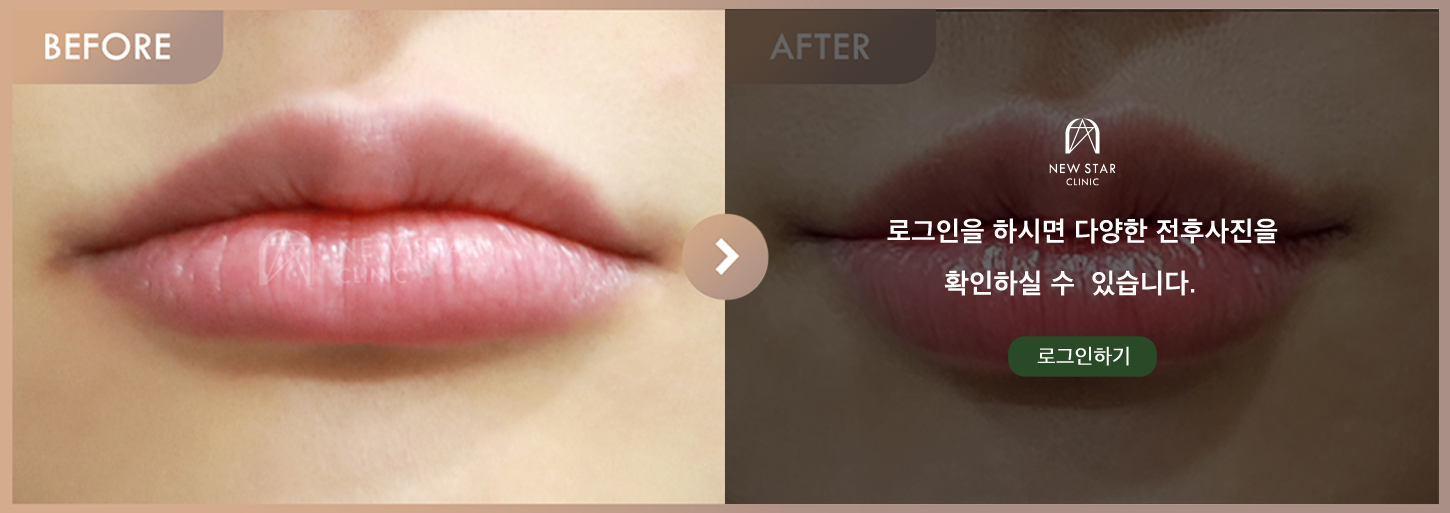 Before & After