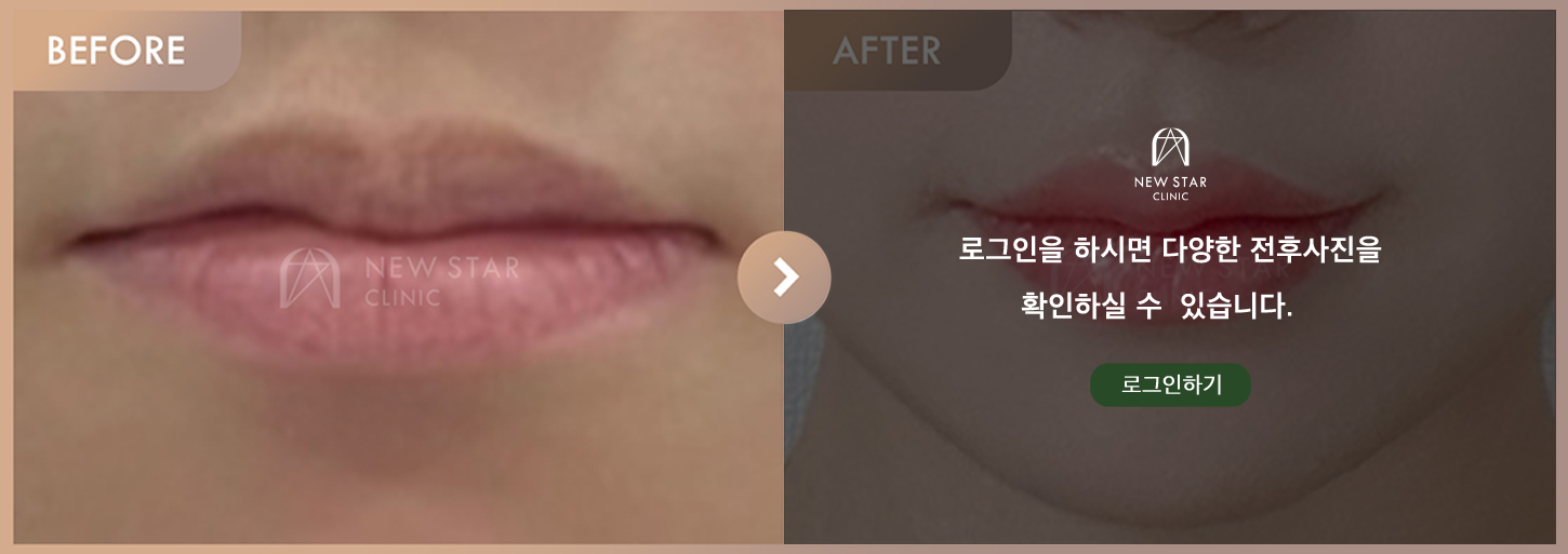 Before & After