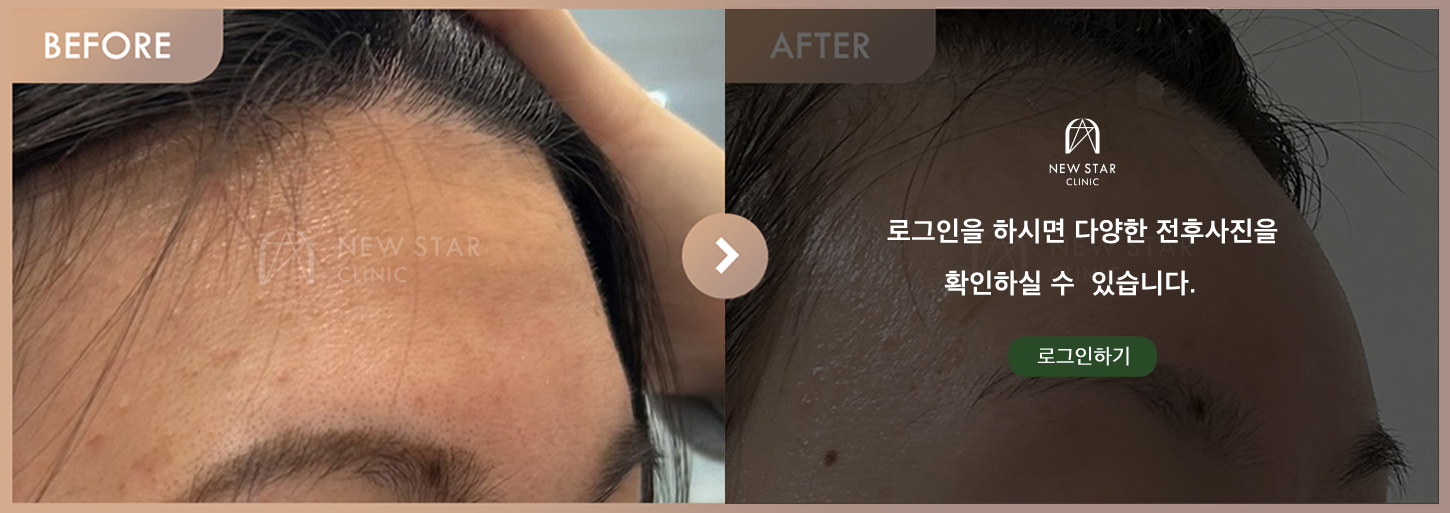 Before & After