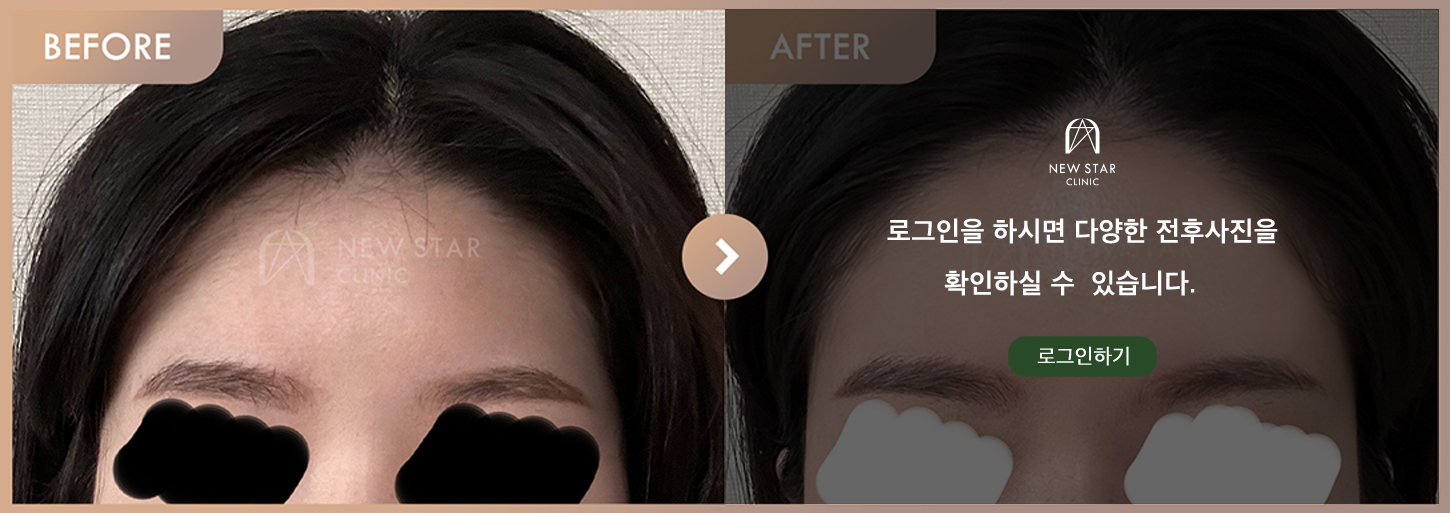 Before & After