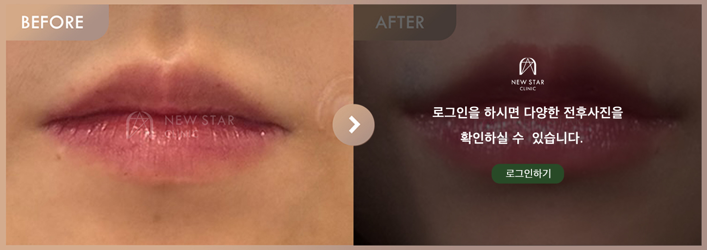 Before & After
