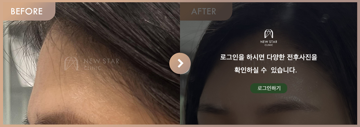 Before & After