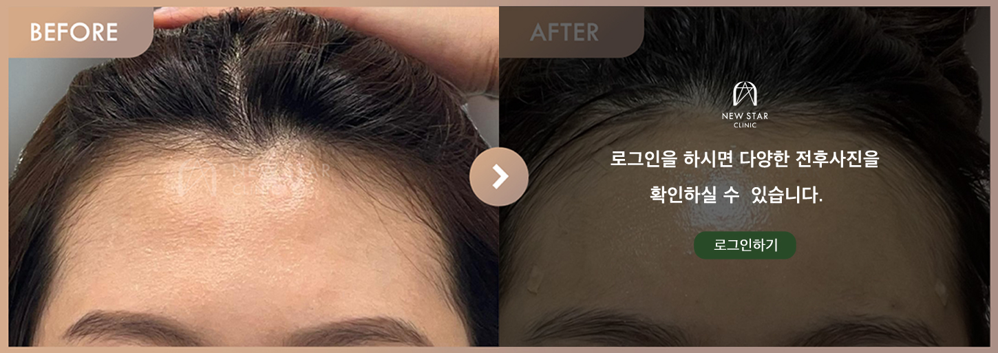 Before & After