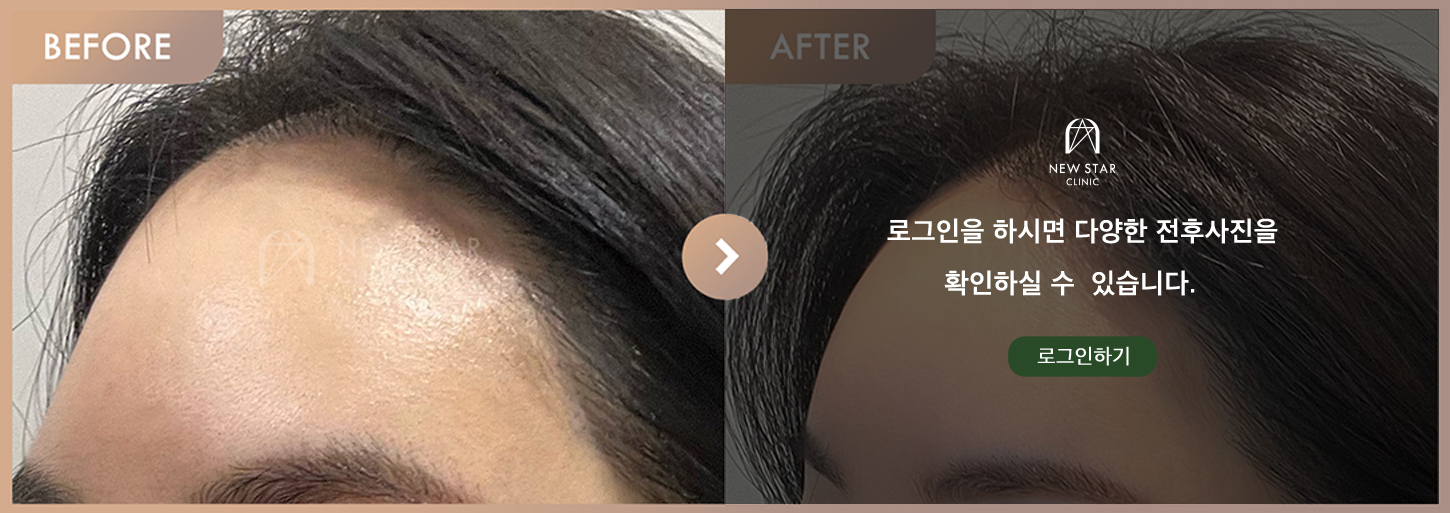 Before & After