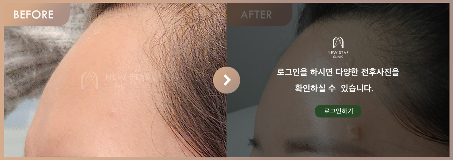 Before & After