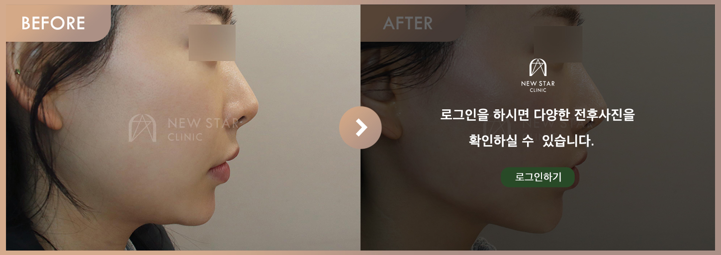 Before & After