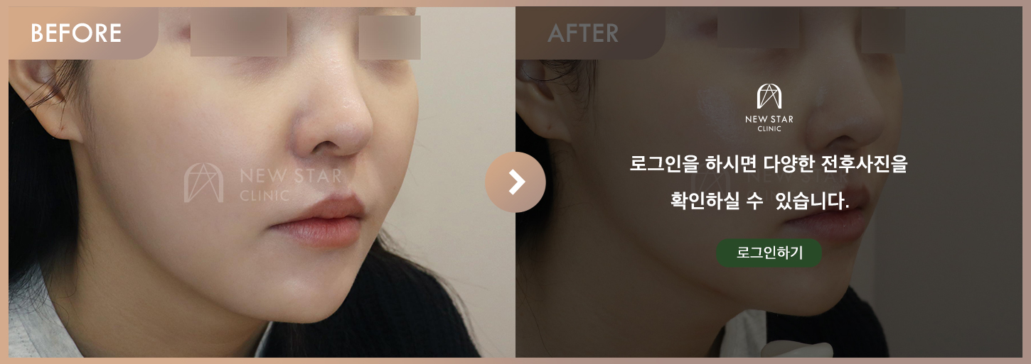 Before & After