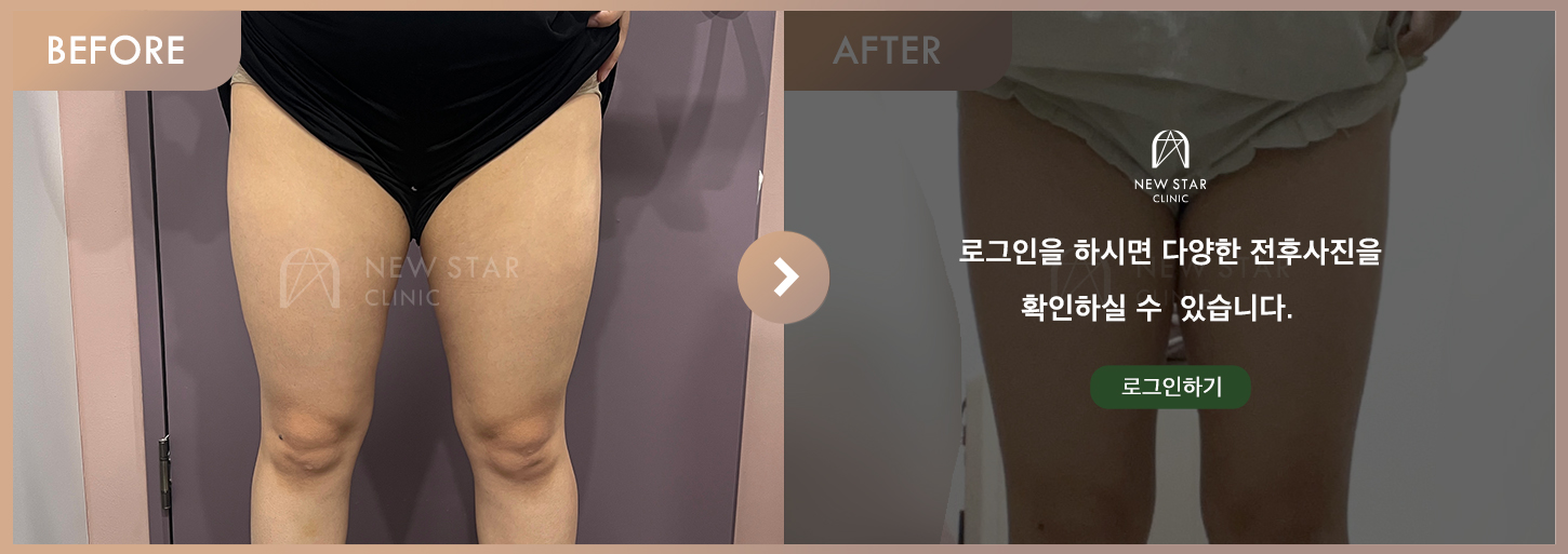 Before & After