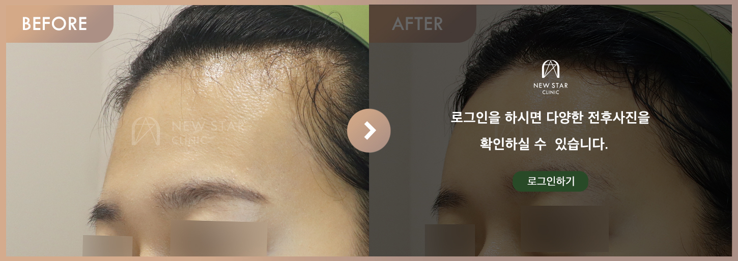 Before & After