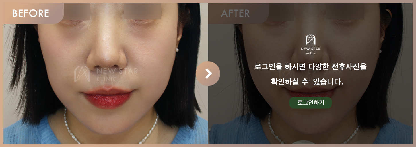 Before & After