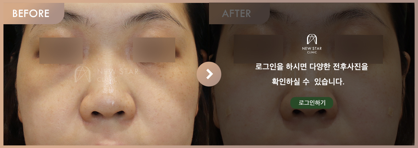 Before & After