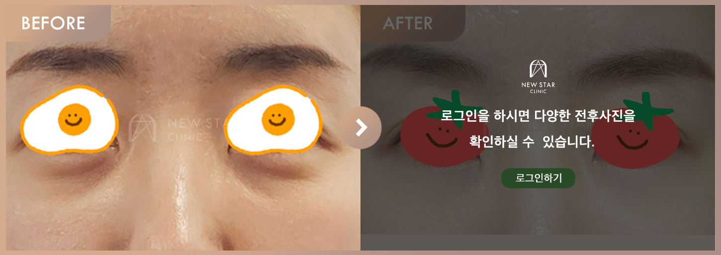 Before & After
