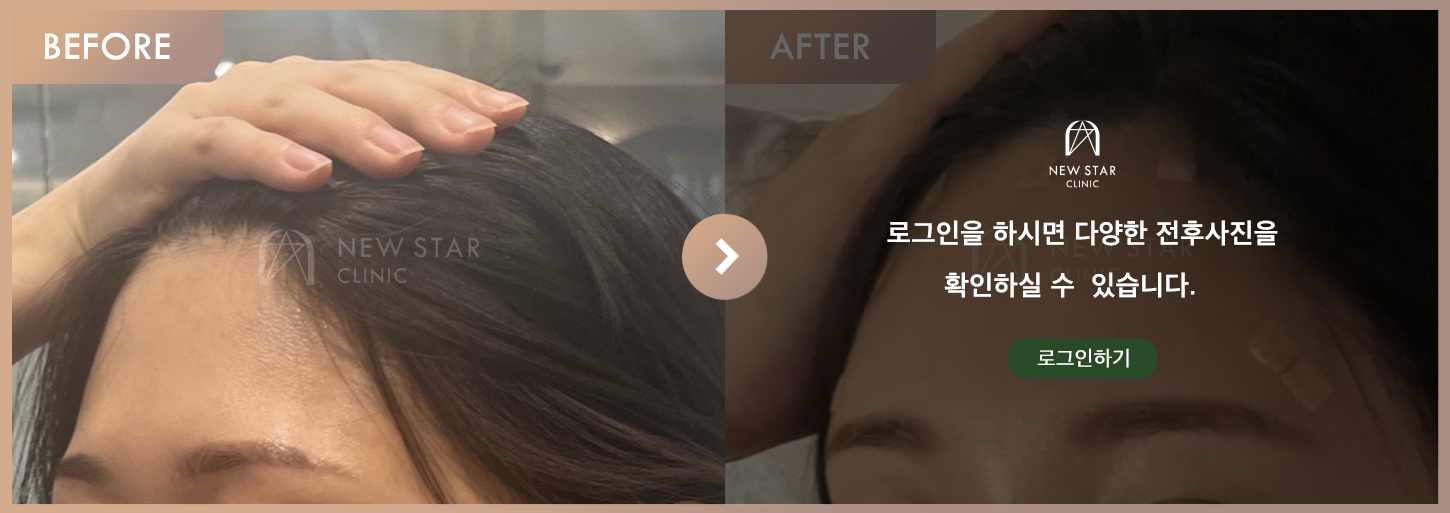 전후사진