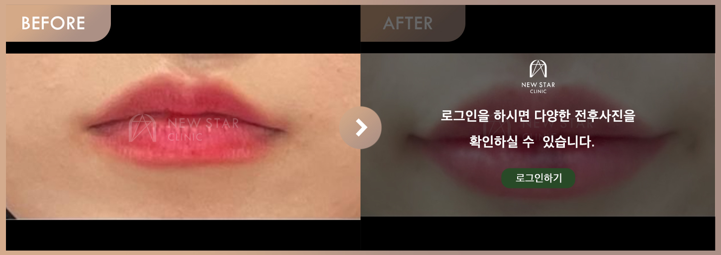 전후사진