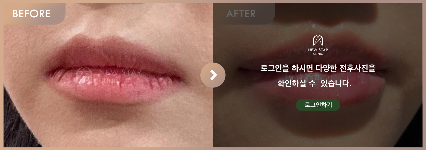 전후사진